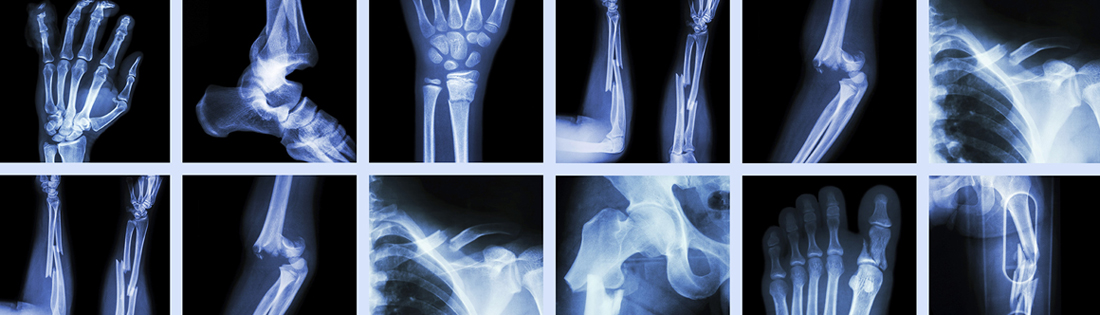 Orthopedic Disorders